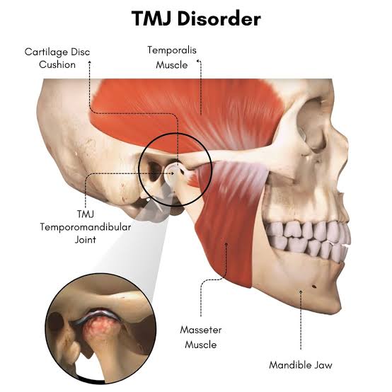 TMJ Clinic Bangladesh